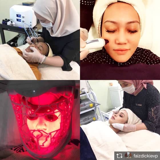 Faizdickie di Prestige Medispa