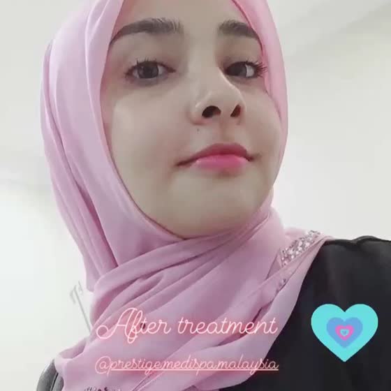 Lufya Omar di Prestige Medispa