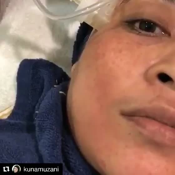 Kuna Muzani di Prestige Medispa